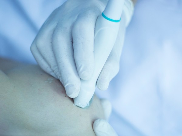electrolisis percutanea madrid